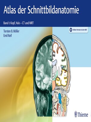 cover image of Atlas der Schnittbildanatomie